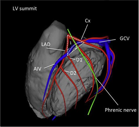 lv summit anatomy|lmca anatomy diagram.